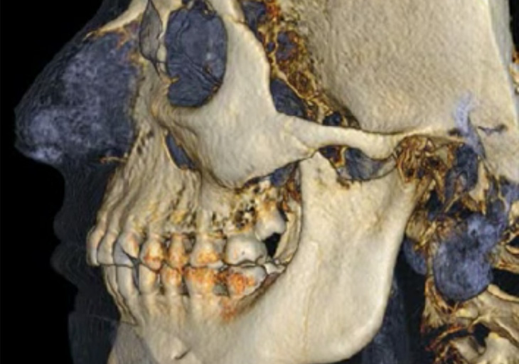 cutting edge orthodontic treatment