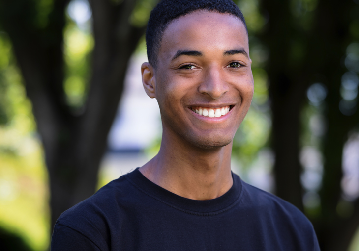 Smile Gallery: braces before and after - invisalign before and after pictures